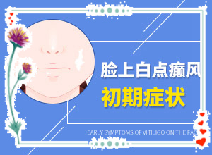 兰州城关区白癜风治疗专业的医院是哪家