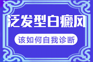 白颠治好后有一辈子不复发的吗