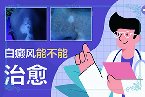下吧下面脖子上有片白斑是什么症状