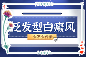 兰州安宁区哪家医院能白癜风