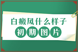 兰州安宁区哪个白癜风医院比较好的治疗