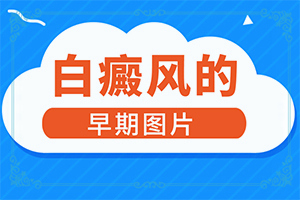 皮肤上突然长出白斑还疼是怎么回事