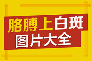 兰州安宁区能白癜风专科医院有哪些