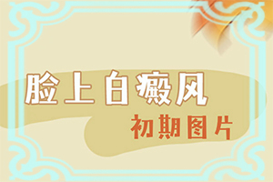白点癫风会对身体有影响吗女性吃什么药