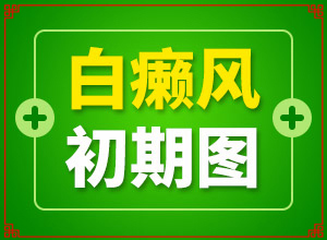 兰州高新区专门治疗白癜风的医院叫什么