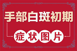 儿童脸部长白斑一般都是什么引起的呢
