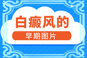 孩子脸上有一小块白是什么原因造成的图片