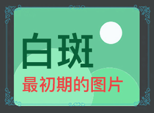初期白点癫风可以治好吗图片视频