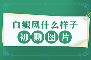 最近皮肤出现白点是什么原因引起的