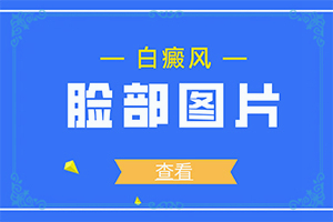 兰州榆中县有可以白癜风的医院吗