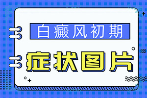 手上有白颠怎么治疗最好
