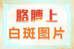 脖子出现小白点是什么原因图片