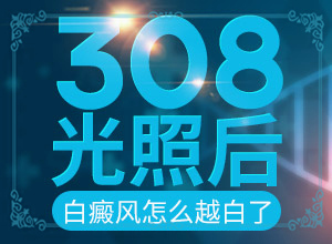 308准激光治疗白斑副作用大不大