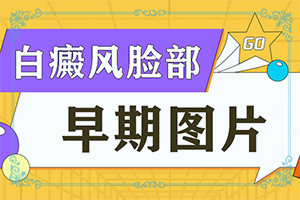 小孩嘴下巴一小块白颠好治吗