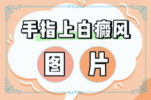 大腿小腿有小白点原因