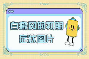 兰州治疗白癜风哪家医院可信度高