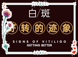 甘肃兰州做白癜风黑色素移植哪个医院好