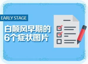 小宝宝头皮上有白色的什么原因