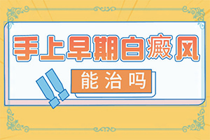 白点癫风外用药膏有哪些