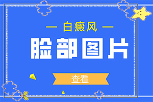 兰州城关区白癜风专业医院都有哪些