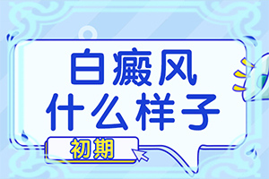 小孩子脸上一块块白的是什么原因图片