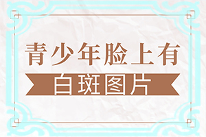 小儿面部白色斑块怎么治疗好
