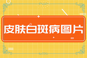手上有小白点是什么原因引起的图片