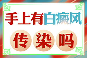 兰州高新区能白癜风专业医院有哪些
