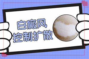 兰州城关区哪个医院治疗白癜风早期症状好