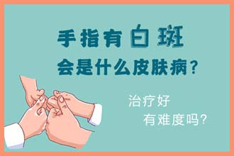 身上出现白块什么原因,你应该看看这个