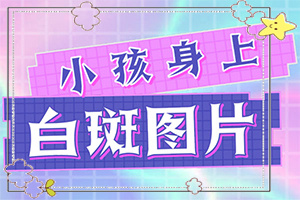 甘肃兰州治疗白癜风值得一去的好医院