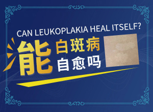 疏通经络对白颠治疗效果怎样