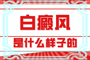头上白颠看了三个月了没有效果