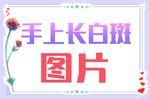 兰州专门治疗白殿的医院哪家好