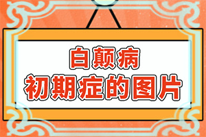 白点癫风最早期发病快吗图片
