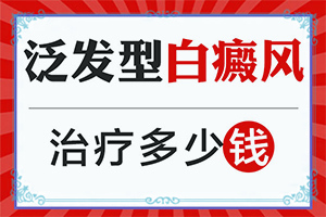 要多少钱才能治疗好白颠风