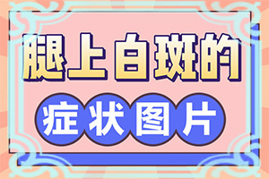 青少年脸上有白斑是怎么回事
