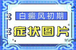 白颠用什么药擦效果好图片