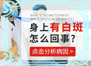 白殿凤是怎么引起的-小孩白癞风是什么原因造成的?