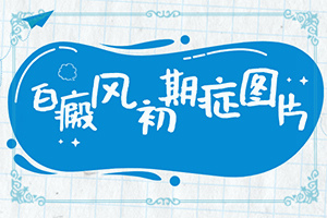 小孩一哭脸上会长一块白斑是怎么回事