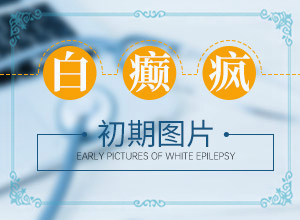 女儿十二岁,脸上有白斑是什么原因