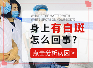 去兰州哪个医院看白癜风的口碑好