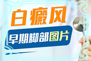 上嘴角有白斑点怎么回事