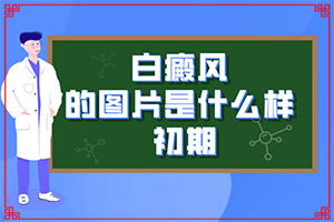 兰州高新区那个医院治疗白癜风比较专业
