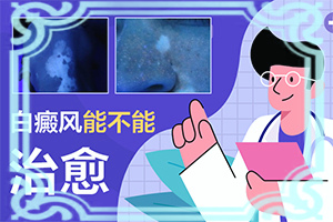 兰州城关区哪个地方可以治疗成人白癜风