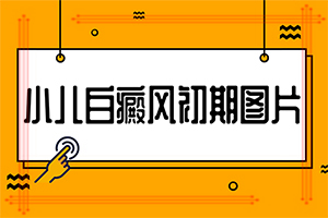 白癫风治疗方法[重大通报]四个月的宝宝脖子下面有白斑