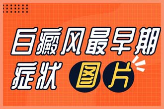皮肤出现白点是什么原因造成的怎么治疗