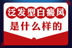 兰州中研白癜风医院正规吗收费如何