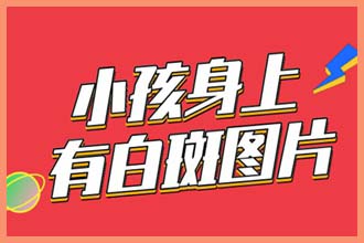 两个月的宝宝 脸上一块块白的是什么原因