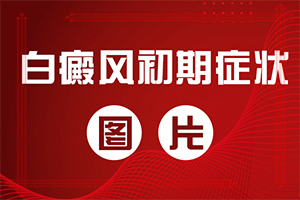 治疗白癜风的药[剖析]白颠疯可以手术吗